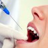 Анестезия при лечении у стоматолога - Стоматологическая клиника "Олимпия"